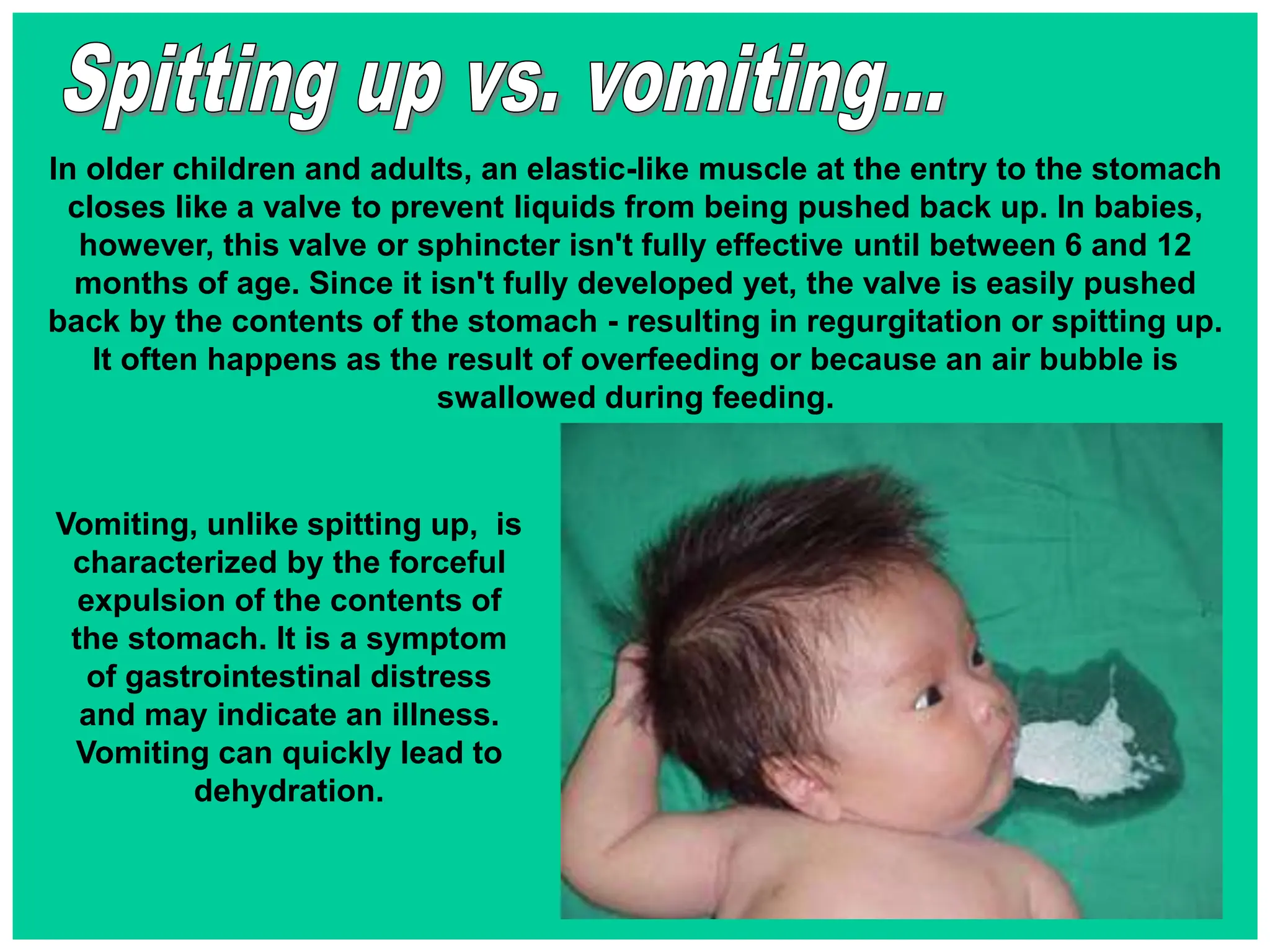 In older children and adults, an elastic-like muscle at the entry to the stomach
closes like a valve to prevent liquids from being pushed back up. In babies,
however, this valve or sphincter isn't fully effective until between 6 and 12
months of age. Since it isn't fully developed yet, the valve is easily pushed
back by the contents of the stomach - resulting in regurgitation or spitting up.
It often happens as the result of overfeeding or because an air bubble is
swallowed during feeding.
Vomiting, unlike spitting up, is
characterized by the forceful
expulsion of the contents of
the stomach. It is a symptom
of gastrointestinal distress
and may indicate an illness.
Vomiting can quickly lead to
dehydration.
 