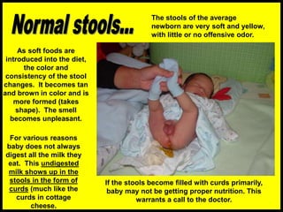 Undigested Milk Image 5-Infant-Care-Techniqueshhhhhhhhhhhhhhhhh.ppt