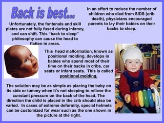 Positional Molding 5-Infant-Care-Techniqueshhhhhhhhhhhhhhhhh.ppt
