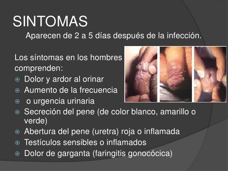 Los pequeños muchachos con el miembro
