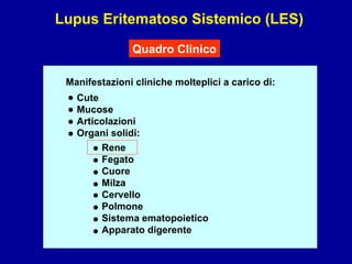 Lupus Eritematoso Sistemico (LES) Quadro Clinico Manifestazioni cliniche molteplici a carico di: Cute Mucose Articolazioni Organi solidi: Rene Fegato Cuore Milza Cervello Polmone Sistema ematopoietico Apparato digerente • • • • • • • • • • • • 