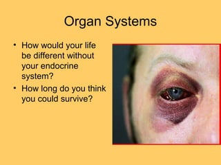 Organ Systems
• How would your life
be different without
your endocrine
system?
• How long do you think
you could survive?
 