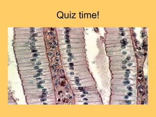 Quiz time!
 