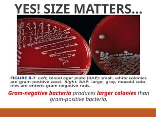 Colonial Examination of Bacterial Isolates | PPTX