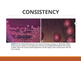 Colonial Examination of Bacterial Isolates | PPTX