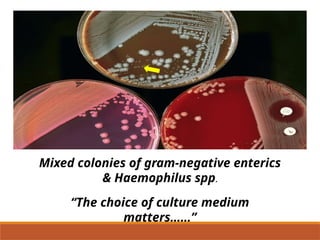 Colonial Examination of Bacterial Isolates | PPTX