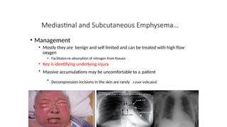 5-min talk on Extrapleural causes of Subcutaneous Emphysema in blunt ...
