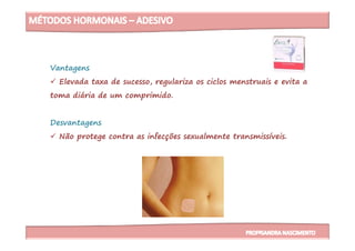 Vantagens
Elevada taxa de sucesso, regulariza os ciclos menstruais e evita a
toma diária de um comprimido.
DesvantagensDesvantagens
Não protege contra as infecções sexualmente transmissíveis.
 