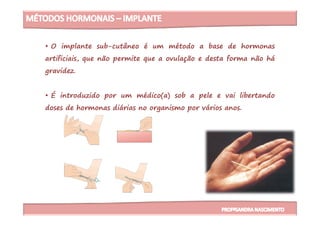 • O implante sub-cutâneo é um método a base de hormonas
artificiais, que não permite que a ovulação e desta forma não há
gravidez.
• É introduzido por um médico(a) sob a pele e vai libertando
doses de hormonas diárias no organismo por vários anos.doses de hormonas diárias no organismo por vários anos.
 
