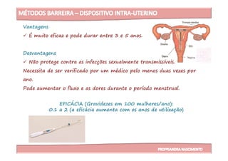Vantagens
É muito eficaz e pode durar entre 3 e 5 anos.
Desvantagens
Não protege contra as infecções sexualmente transmissíveis.
Necessita de ser verificado por um médico pelo menos duas vezes por
ano.ano.
Pode aumentar o fluxo e as dores durante o período menstrual.
EFICÁCIA (Gravidezes em 100 mulheres/ano):
0.1 a 2 (a eficácia aumenta com os anos de utilização)
 