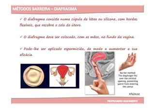 O diafragma consiste numa cúpula de látex ou silicone, com bordas
flexíveis, que recobre o colo do útero.
O diafragma deve ser colocado, com as mãos, no fundo da vagina.
Pode-lhe ser aplicado espermicida, de modo a aumentar a sua
eficácia.eficácia.
 