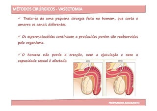 Trata-se de uma pequena cirurgia feita no homem, que corta e
amarra os canais deferentes.
Os espermatozóides continuam a produzidos porém são reabsorvidos
pelo organismo.
O homem não perde a erecção, nem a ejaculação e nem aO homem não perde a erecção, nem a ejaculação e nem a
capacidade sexual é afectada
 