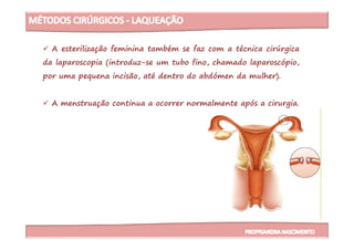 A esterilização feminina também se faz com a técnica cirúrgica
da laparoscopia (introduz-se um tubo fino, chamado laparoscópio,
por uma pequena incisão, até dentro do abdómen da mulher).
A menstruação continua a ocorrer normalmente após a cirurgia.
 