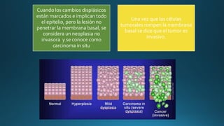 Cuando los cambios displásicos
están marcados e implican todo
el epitelio, pero la lesión no
penetrar la membrana basal, se
considera un neoplasia no
invasora y se conoce como
carcinoma in situ
Una vez que las células
tumorales rompen la membrana
basal se dice que el tumor es
invasivo.
 