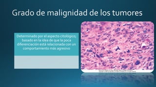 Determinado por el aspecto citológico;
basado en la idea de que la poca
diferenciación está relacionada con un
comportamiento más agresivo
 