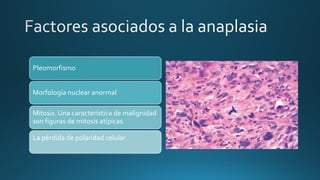 Pleomorfismo
Morfología nuclear anormal
Mitosis. Una característica de malignidad
son figuras de mitosis atípicas
La pérdida de polaridad celular
 