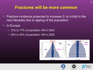 10

Fractures will be more common
• Fracture incidence projected to increase 2- to 4-fold in the
next decades due to ageing of the population
• In Europe
– 12% to 17% of population >65 in 2002
– 20% to 25% of population >65 in 2025
Aged 70+
1990

Men

Women

2030
Men

Women

 