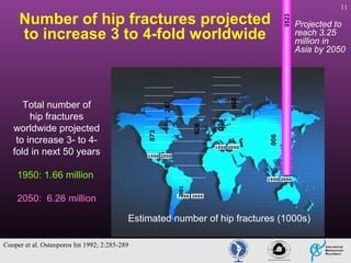 1950 2050

05 23

006

004

873

926

247

Total number of
hip fractures
worldwide projected
to increase 3- to 4fold in next 50 years

Projected to
reach 3.25
million in
Asia by 2050

866

Number of hip fractures projected
to increase 3 to 4-fold worldwide

11

1950 2050

1950: 1.66 million
001

1950 2050

2050: 6.26 million

1950 2050

Estimated number of hip fractures (1000s)
Cooper et al. Osteoporos Int 1992; 2:285-289

 