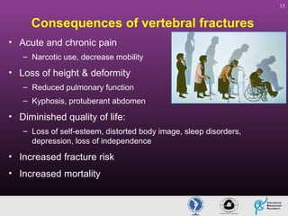 15

Consequences of vertebral fractures
• Acute and chronic pain
– Narcotic use, decrease mobility

• Loss of height & deformity
– Reduced pulmonary function
– Kyphosis, protuberant abdomen

• Diminished quality of life:
– Loss of self-esteem, distorted body image, sleep disorders,
depression, loss of independence

• Increased fracture risk
• Increased mortality

 
