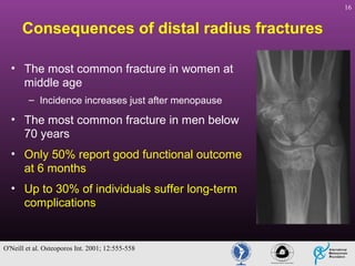 16

Consequences of distal radius fractures
• The most common fracture in women at
middle age
– Incidence increases just after menopause

• The most common fracture in men below
70 years
• Only 50% report good functional outcome
at 6 months
• Up to 30% of individuals suffer long-term
complications

O'Neill et al. Osteoporos Int. 2001; 12:555-558

 