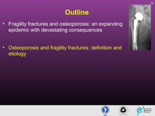 24

Outline
• Fragility fractures and osteoporosis: an expanding
epidemic with devastating consequences
• Osteoporosis and fragility fractures: definition and
etiology

 