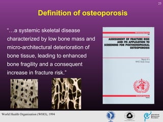 25

Definition of osteoporosis
“…a systemic skeletal disease
characterized by low bone mass and
micro-architectural deterioration of
bone tissue, leading to enhanced
bone fragility and a consequent
increase in fracture risk.”

World Health Organization (WHO), 1994

 