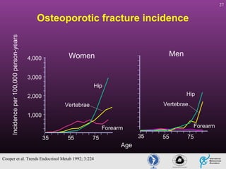 27

Incidence per 100,000 person-years

Osteoporotic fracture incidence

Men

Women

4,000
3,000

Hip
Hip

2,000

Vertebrae

Vertebrae
1,000

Forearm

Forearm
35

55

35

75

Age
Cooper et al. Trends Endocrinol Metab 1992; 3:224

55

75

 