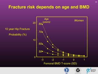 29

Fracture risk depends on age and BMD

20

10 year Hip Fracture

80

Age
(years)

Women

70

Probability (%)
10

60
50
0

-3

-2

-1

0

Femoral BMD T-score (SD)

1

 