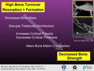 38

High Bone Turnover
Resorption > Formation
Decreases Bone Mass
Disrupts Trabecular Architecture
Increases Cortical Porosity
Decreases Cortical Thickness

L. Mosekilde
Tech and Health Care, 1998

Alters Bone Matrix Composition

Decreased Bone
Strength
Bouxsein. Best Practice in Clin Rheum. 2005; 19:897-911
Seeman & Delmas, New England J Med, 2006; 354:2250-61

 