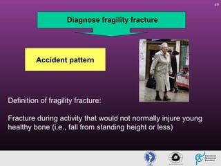 49

Diagnose fragility fracture

Accident pattern

Definition of fragility fracture:
Fracture during activity that would not normally injure young
healthy bone (i.e., fall from standing height or less)

 