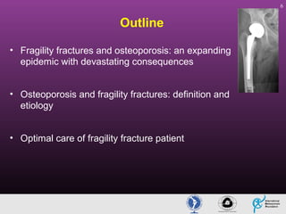 6

Outline
• Fragility fractures and osteoporosis: an expanding
epidemic with devastating consequences
• Osteoporosis and fragility fractures: definition and
etiology
• Optimal care of fragility fracture patient

 