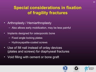 60

Special considerations in fixation
of fragility fractures
• Arthroplasty / Hemiarthroplasty
– Also allows early mobilization, may be less painful
• Implants designed for osteoporotic bone
– Fixed angle locking plates
– Hydroxyapatite-coated screws

• Use of IM nail instead of onlay devices
(plates and screws) for diaphyseal fractures
• Void filling with cement or bone graft

 