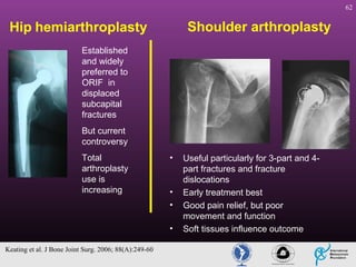 62

Shoulder arthroplasty

Hip hemiarthroplasty
Established
and widely
preferred to
ORIF in
displaced
subcapital
fractures
But current
controversy
Total
arthroplasty
use is
increasing

•

•
•
•

Keating et al. J Bone Joint Surg. 2006; 88(A):249-60

Useful particularly for 3-part and 4part fractures and fracture
dislocations
Early treatment best
Good pain relief, but poor
movement and function
Soft tissues influence outcome

 