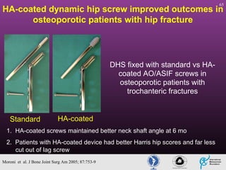 65

HA-coated dynamic hip screw improved outcomes in
osteoporotic patients with hip fracture

DHS fixed with standard vs HAcoated AO/ASIF screws in
osteoporotic patients with
trochanteric fractures

Standard

HA-coated

1. HA-coated screws maintained better neck shaft angle at 6 mo
2. Patients with HA-coated device had better Harris hip scores and far less
cut out of lag screw
Moroni et al. J Bone Joint Surg Am 2005; 87:753-9

 
