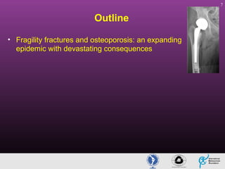 7

Outline
• Fragility fractures and osteoporosis: an expanding
epidemic with devastating consequences

 