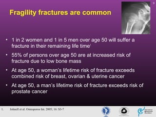9

Fragility fractures are common

• 1 in 2 women and 1 in 5 men over age 50 will suffer a
fracture in their remaining life time1
• 55% of persons over age 50 are at increased risk of
fracture due to low bone mass
• At age 50, a woman’s lifetime risk of fracture exceeds
combined risk of breast, ovarian & uterine cancer
• At age 50, a man’s lifetime risk of fracture exceeds risk of
prostate cancer

1.

Johnell et al. Osteoporos Int. 2005; 16: S3-7

 