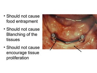 • Should not cause
food entrapment
• Should not cause
Blanching of the
tissues
• Should not cause
encourage tissue
proliferation
 