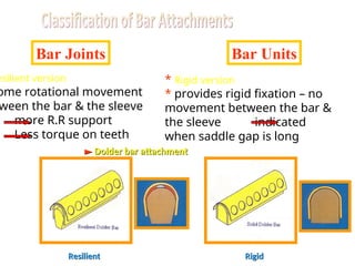 Bar Joints Bar Units
esilient version
ome rotational movement
ween the bar & the sleeve
more R.R support
Less torque on teeth
* Rigid version
* provides rigid fixation – no
movement between the bar &
the sleeve indicated
when saddle gap is long
►
► Dolder bar attachment
Dolder bar attachment
Resilient
Resilient Rigid
Rigid
 