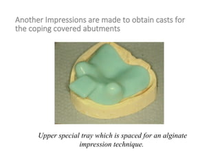 Another Impressions are made to obtain casts for
the coping covered abutments
Upper special tray which is spaced for an alginate
impression technique.
 