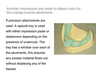 Another Impressions are made to obtain casts for
the coping covered abutments
If precision attachments are
used. A special tray is used
with either impression paste or
elastomers depending on the
presence of undercuts. The
tray has a window over each of
the abutments, this ensures
any excess material flows out,
without displacing any of the
tissues
 