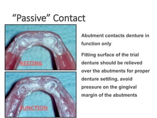 “Passive” Contact
Abutment contacts denture in
function only
Fitting surface of the trial
denture should be relieved
over the abutments for proper
denture settling, avoid
pressure on the gingival
margin of the abutments
RESTING
FUNCTION
 