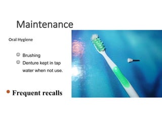 Maintenance
Oral Hygiene
 Brushing
 Denture kept in tap
water when not use.
Frequent recalls
For post insertion care and prophylactic care of abutments. (fluoride
application)
 