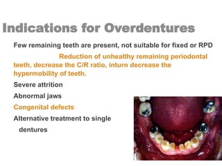 Indications for Overdentures
Few remaining teeth are present, not suitable for fixed or RPD
Mobile teeth: Reduction of unhealthy remaining periodontal
teeth, decrease the C/R ratio, inturn decrease the
hypermobility of teeth.
Severe attrition
Abnormal jaws
Congenital defects
Alternative treatment to single
dentures
 