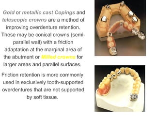 Gold or metallic cast Copings and
telescopic crowns are a method of
improving overdenture retention.
These may be conical crowns (semi-
parallel wall) with a friction
adaptation at the marginal area of
the abutment or Milled crowns for
larger areas and parallel surfaces.
Friction retention is more commonly
used in exclusively tooth-supported
overdentures that are not supported
by soft tissue.
 