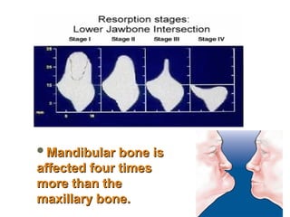 Mandibular bone is
Mandibular bone is
affected four times
affected four times
more than the
more than the
maxillary bone.
maxillary bone.
 