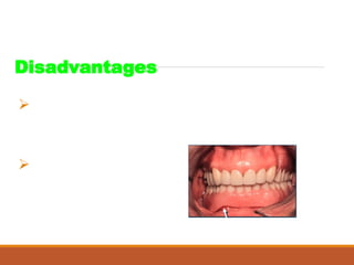 Disadvantages
Can’t place flange in some undercuts
in overdenture attachments
Cost
 