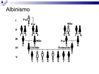 Albinismo
 