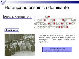 Herança autossômica dominante
Doença de Huntington (DHq)




 Acondrolasia

                             Um tipo de nanismo acentuado, sem retardo
                             mental, cabeça grande e testa saliente. Em
                             homozigose é letal. Pode ocorrer casos
                             esporádicos.



                                          Indivíduo Normal: aa
                                  Indivíduo Acondroplásico: AA ou Aa
 