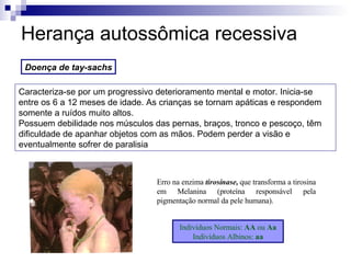 Herança autossômica recessiva Doença de tay-sachs Erro na enzima  tirosinase,  que transforma a tirosina em Melanina (proteína responsável pela pigmentação normal da pele humana). Indivíduos Normais:  AA  ou  Aa Indivíduos Albinos:  aa Caracteriza-se por um progressivo deterioramento mental e motor. Inicia-se entre os 6 a 12 meses de idade. As crianças se tornam apáticas e respondem somente a ruídos muito altos. Possuem debilidade nos músculos das pernas, braços, tronco e pescoço, têm dificuldade de apanhar objetos com as mãos. Podem perder a visão e eventualmente sofrer de paralisia  