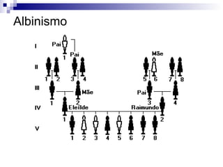 Albinismo 
